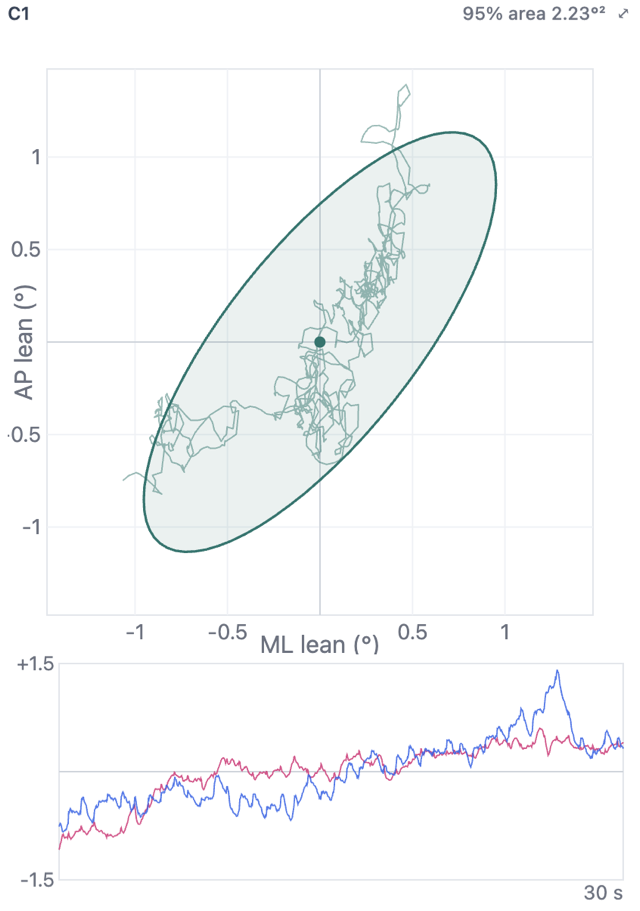 A client's sway path for the firm, eyes-open condition: the trace of their body lean with a 95% ellipse, and the 30-second forward-back and side-to-side trace below.